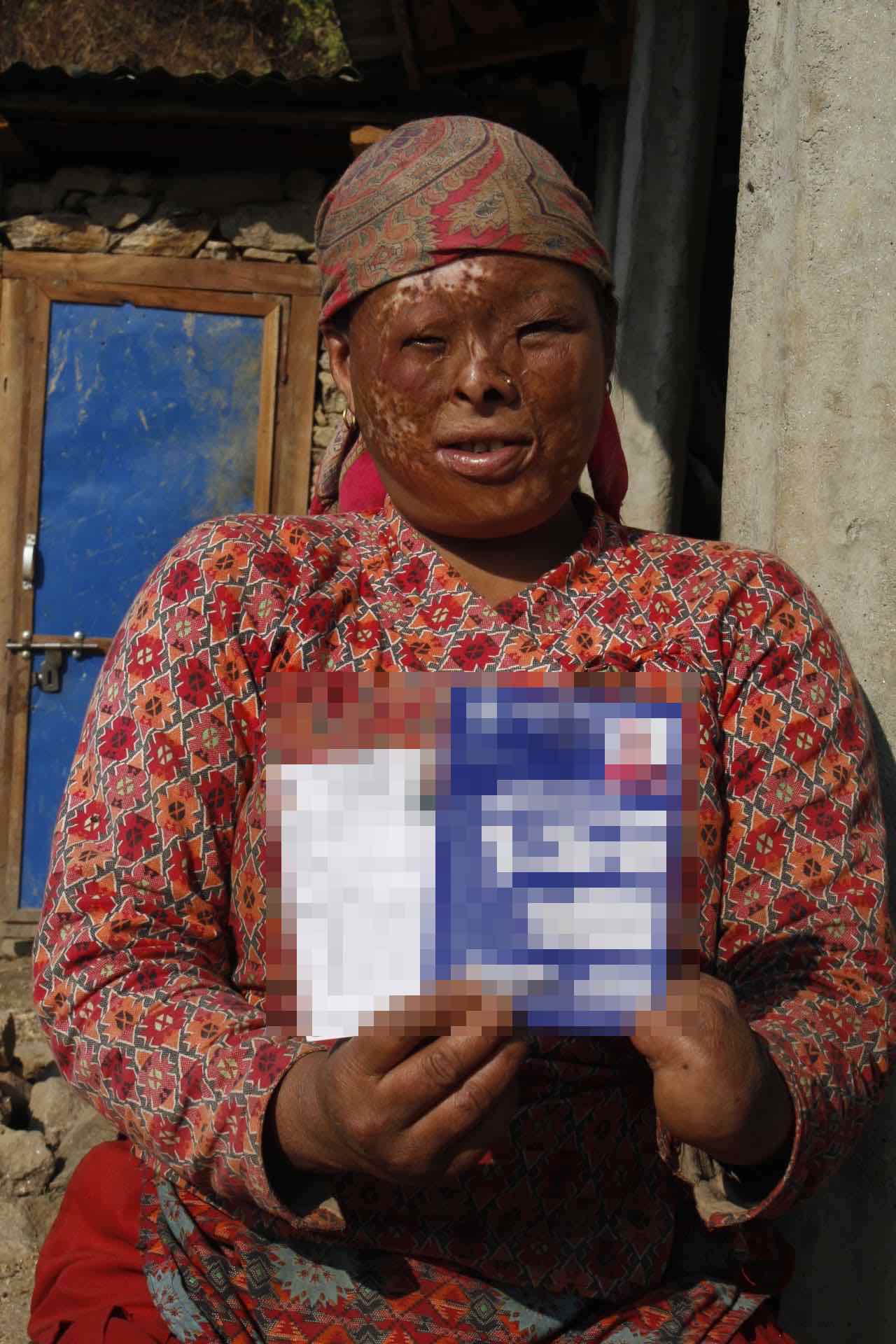 A woman with a disability holding her disability identity card after receiving poultry-rearing support in Rautbesi, Nuwakot